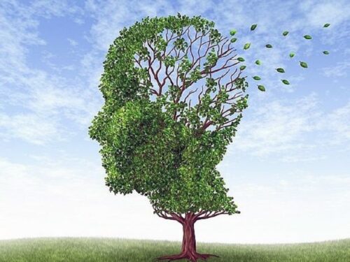 La malattia di Alzheimer